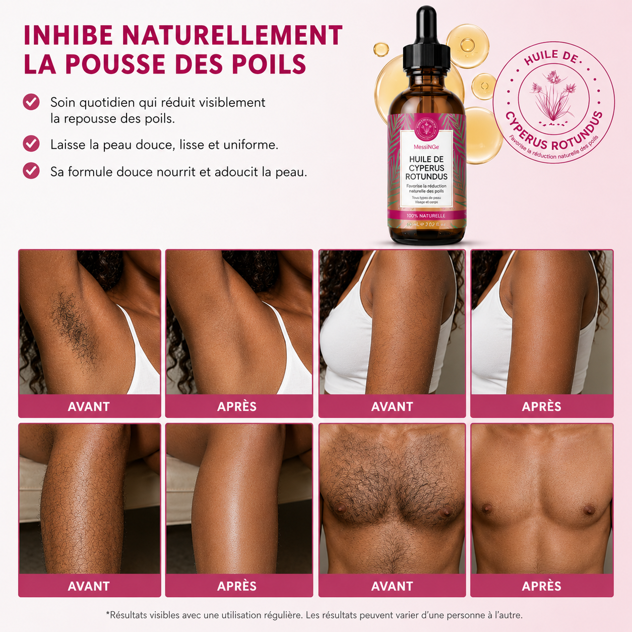 ✨Sérum après rasage : Cette huile ralentit la repousse pour de bon 